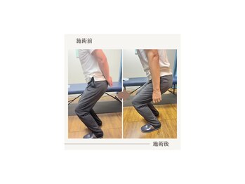 バレルメディカル研究所 恵比寿/膝前十字靭帯断裂後のリハビリ