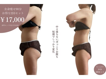 フィカス(FICUS)の写真