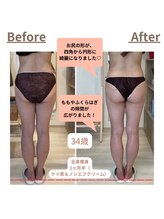 ビー肌スパ(Be肌スパ)/ビフォアアフター画像