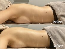 ティアモ(Ti Amo)/ガチガチ背中が1回でぺたんこに