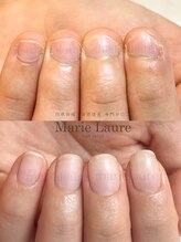 マリーロール 梅田店(Marie Laure)/深爪改善/自爪育成/ネイルケア