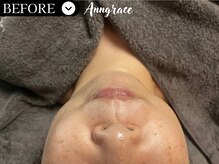 アングレイス(Anngrace)/護りの抗酸化【ポールシェリー】