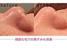 ファニービー 茨木店/Before →After 