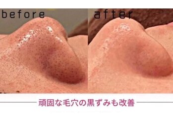 ファニービー 茨木店/Before →After