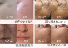 ソリシア(SORISIA)