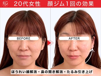 那賀洋子式 顔ジム 大分戸次店/20代女性顔ジム1回の効果