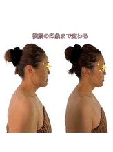 スカイ(sky)/頭蓋骨立体小顔矯正