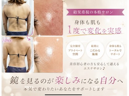 アスピリア(aspirer a')の写真