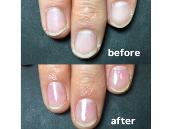 ゾゾ イリプレッセブル(ZOZO irreplaceable)/