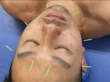 はりきゅう漫々の写真