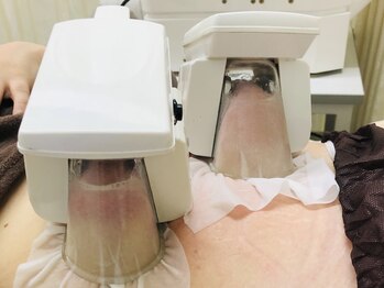 ラフレーズ 田原店の写真/痩せる事を諦めていた方には【脂肪冷却選べる部位2カップ×ハイパーキャビテーション¥11000】がオススメ!