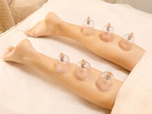 カッピングアンドカッサ専門店 凜(Rin)/カッピング　あし