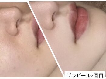 ビジュー(BIJOU)/