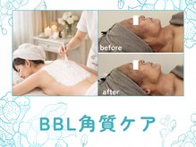トッコ 那須塩原店(tocco)の雰囲気（《最新技術BBL》であらゆる肌悩みを集中改善！）