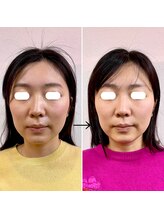 横浜DRT矯正院/小顔・美顔矯正