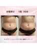 脂肪燃焼X発汗ジェル使用！お腹周り美くびれコース35分¥4000→