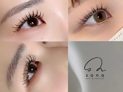 ソナ(sona)の写真