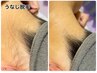 再来のお客様 【うなじのみ脱毛】¥2,000