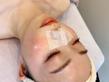 アロハマリエ(aloha malie)/毛穴角栓ローションで柔らかく