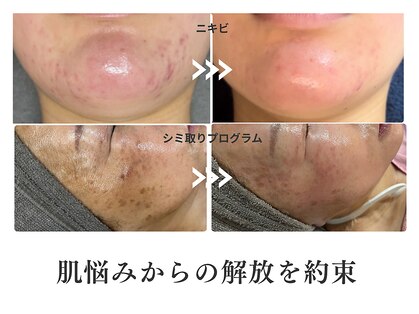 アクシア(Axia)の写真