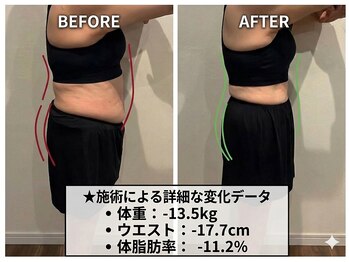 くによし整体院の写真/年齢による代謝ダウンを攻略!骨盤調整による血流促進×遺伝子分析で、きつくなったズボンもスッキリ!