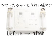 ブランシェ 金沢店 × 椿/奇跡の表情筋ケア☆効果を即実感