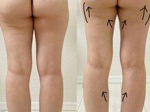 エクリル(Eclire)/小尻＆美脚