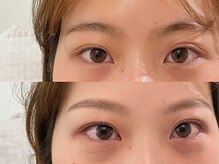 アンバイアオ 本町(UN by ao.)/美眉+ラッシュリフト