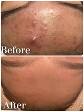 命の洗濯/８ヶ月/RFフォト/フェイシャル