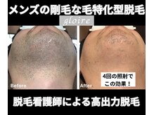 グロワール(gloire)