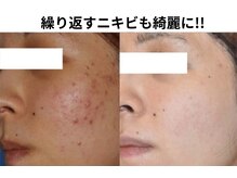 ファニービー 茨木店/