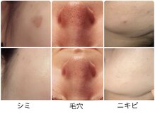 ルヴィショップ 沖縄(REVI SHOP)