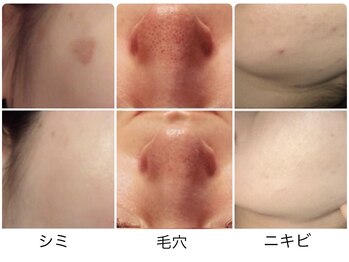 ルヴィショップ 沖縄(REVI SHOP)