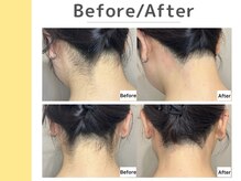 キングスサロン 神戸ハーバーランド店/〈 Before / After 〉