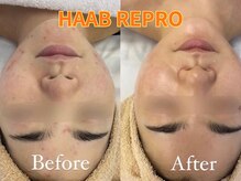 ベルシャトン(Belle Chaton)/