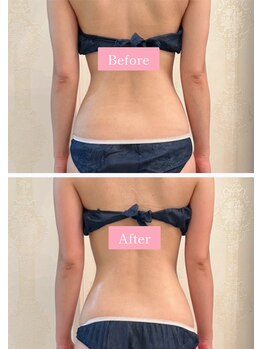 ヴェルセーヌ(VelleSaine)/美くびれでスタイルアップ♪