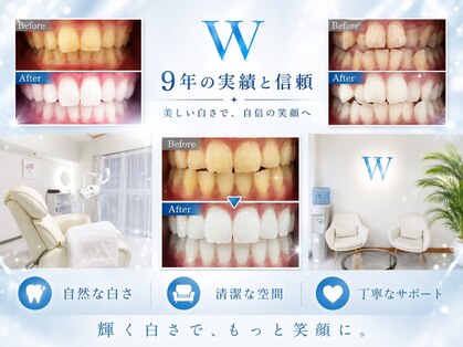 ホワイトニングショップ 仙台店の写真