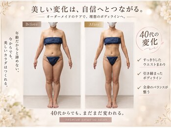 エステティックサロン サロン ド ヴィーナス 新宿店の写真/ボディラインを変えたい。そう思った今が、変わりどき。