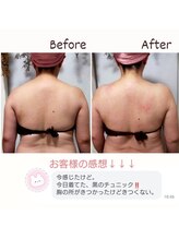 ルクラージュ(Le courage)/肩こり＆サイズダウンも!!