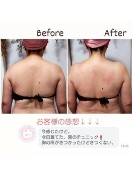 ルクラージュ(Le courage)/肩こり＆サイズダウンも!!