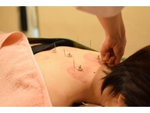 鍼灸院リビング(Living)/施術部以外はタオルをかけてます