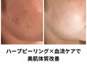 【くすみ・ニキビケアに】当サロンNO.1メニュー　¥18700→¥11000