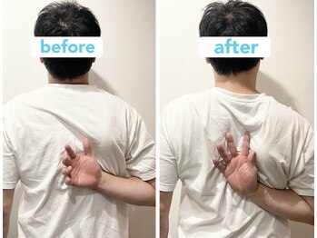 ウル鍼灸整骨院/肩関節の可動域拡大♪