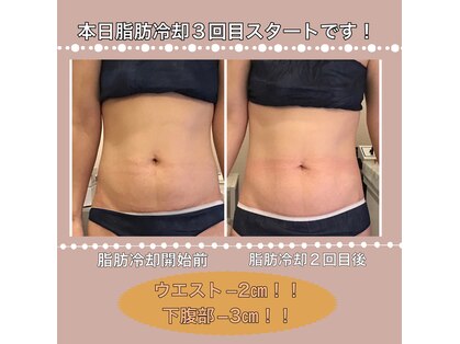 わたしのエステ 安城店の写真