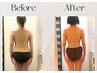 【痩身・全身一撃】ハイパーナイフ×究極デトックスの活性化リンパ120分　