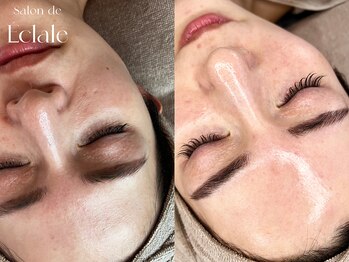 サロンドエクラル(Salon de Eclale wax)/ハーブリプロ/ハーブピーリング