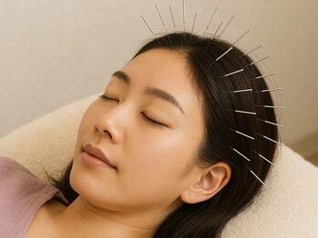 鍼灸J/O治療院の写真/鍼灸師の信頼できる高い技術力の施術！ヘッドスパ以上の実感で頭痛・自律神経に◎