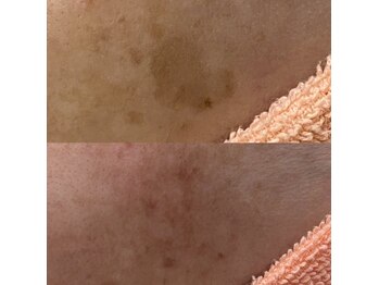 インディバ痩身サロン シュエット(Chouette)