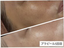 ビジュー(BIJOU)/