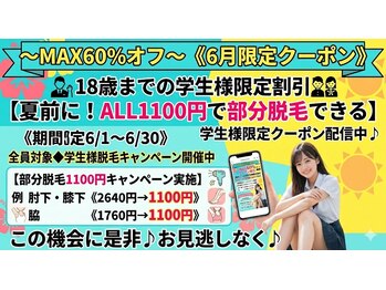 ソイズエステティクスの写真/~MAX60%オフ~《6月限定クーポン》18歳までの学生様限定割引【夏前に!ALL1100円で部分脱毛できる】